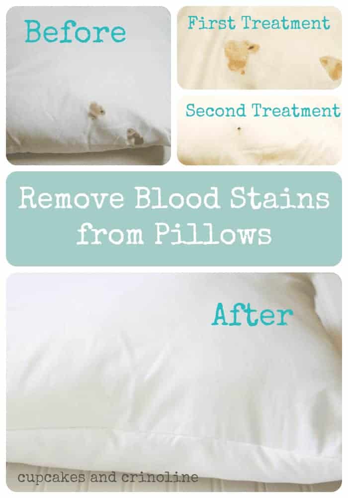 How To Remove Blood Stains