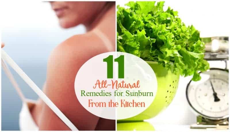 DIY Natural Remedies For Sunburn